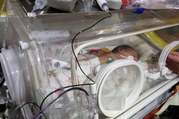 Syrian baby surgery israel