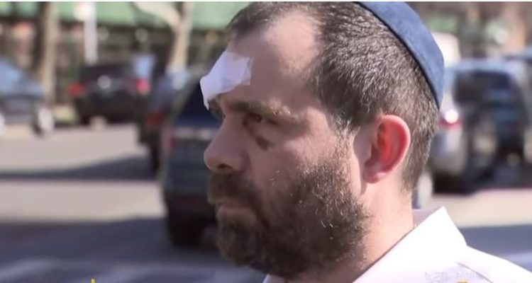 ‘It doesn’t stop’: Orthodox Jewish man violently attacked in Brooklyn