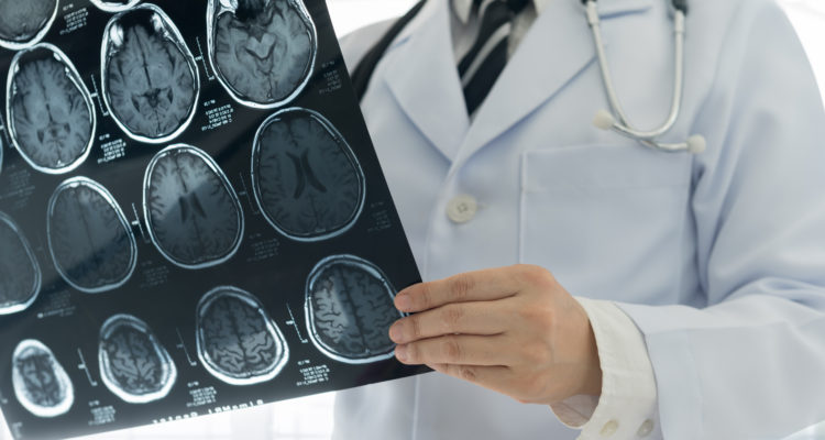 ‘Profound correlation’: Doctors believe Covid-19 causing strokes in young
