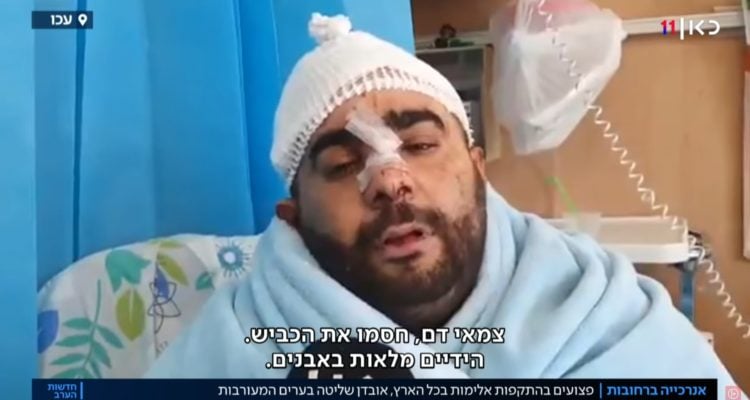 IDF soldier in critical condition after Arab mob in Jaffa cracks his skull