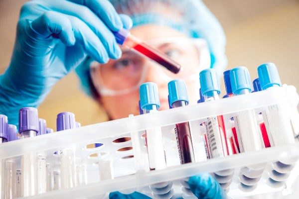 blood test