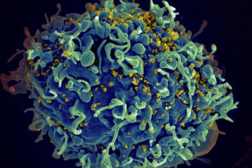 HIV, the AIDS virus (yellow), infecting a human cell (Credit: Flickr)