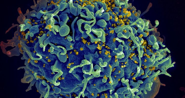 Medical miracle? Woman ‘naturally’ cured of HIV