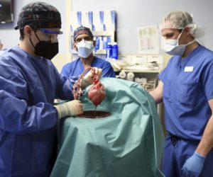 pig heart for transplant