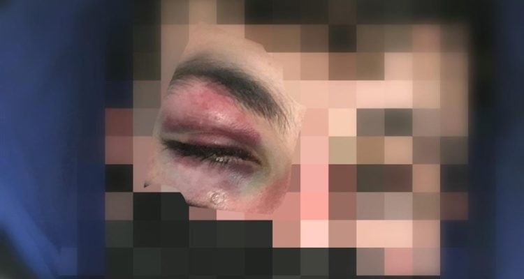Jewish man beaten, then arrested alongside Arab attacker