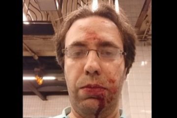 Jewish victim of NY subway assault