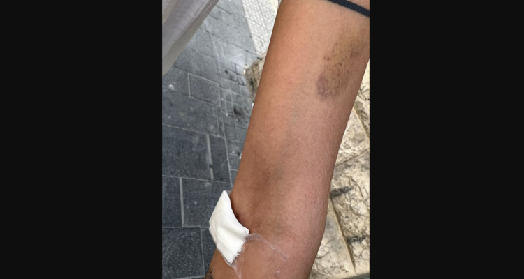 ‘I’m traumatized’ – Arab woman, mistaken for Jew, brutally beaten in Jerusalem