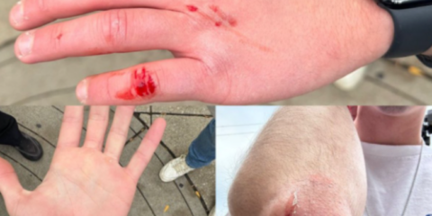 depaul assault