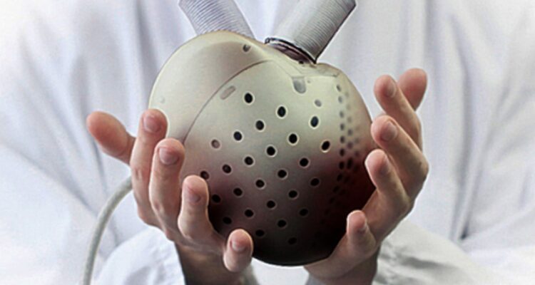 Medical breakthrough in Israel: Artificial heart implanted at Hadassah Ein Kerem