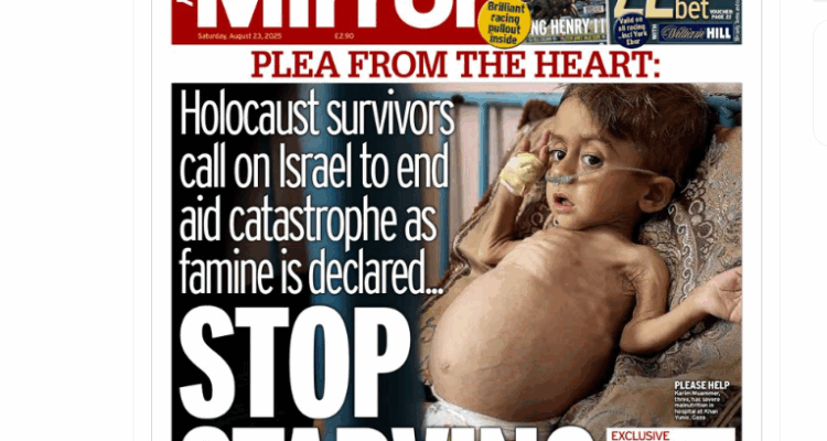 Israel proves ’emaciated’ Gazan child on front cover story has a genetic illness