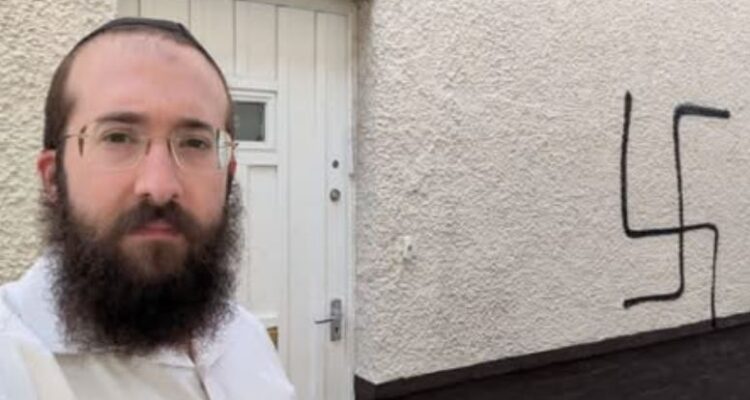 UK antisemitism – Jewish teen shot in the head with air rifle
