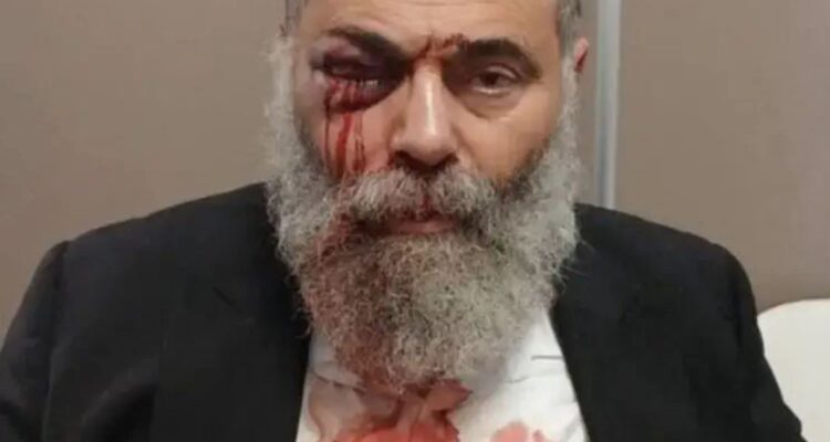Jewish man brutally beaten in France on Shabbat