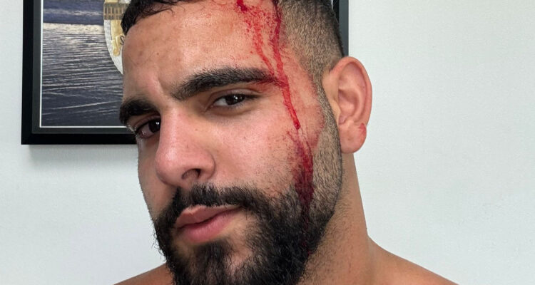 Slain Israeli hostage’s cousin brutally beaten in LA