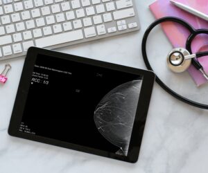 Mammogram scan