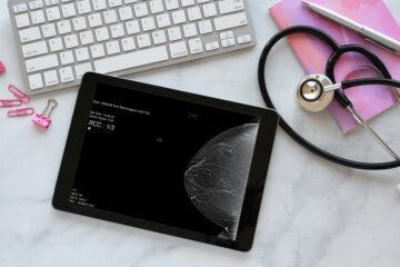 Mammogram scan