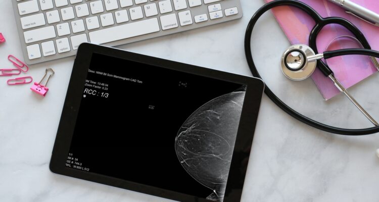 Landmark AI breast-cancer screening to be launched in Israel this year