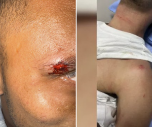 Thailand antisemitic attack