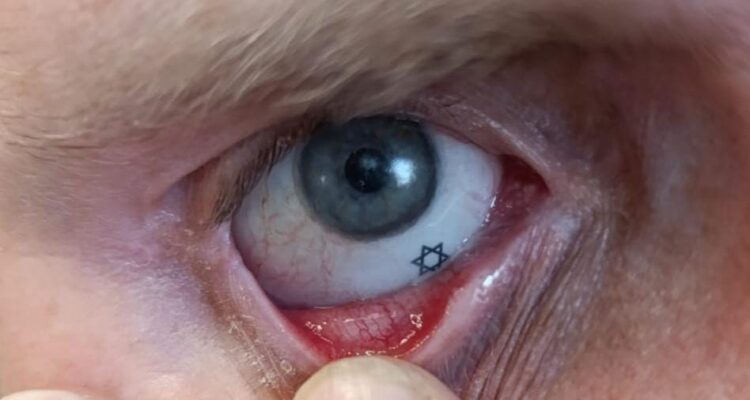 Injured Border Police officer returns to training with custom prosthetic eye