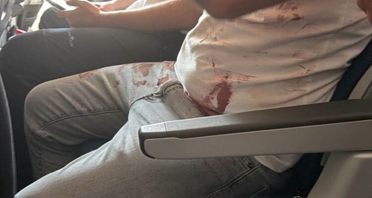 Antisemitic conspiracies spread immediately after Flydubai attack